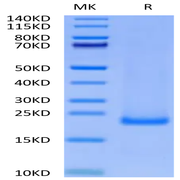 Cynomolgus MD2 Protein (MD2-CE102) Cynomolgus MD2 Protein (MD2-CE102)