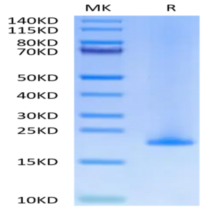Human MD2 Protein (MD2-HE102)