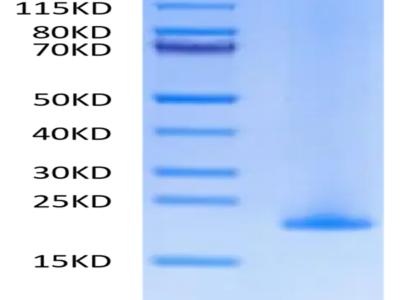 Human MD2 Protein (MD2-HE102)