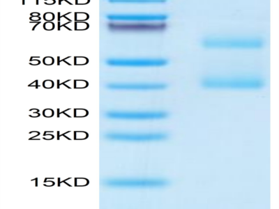 Mouse MEPE Protein (MEP-MM101)