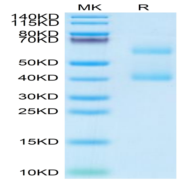 Mepe Mouse MEPE Protein (MEP-MM101) | KACTUS Biosystems | Ushelf
