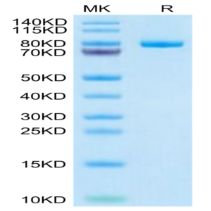 Human CD228/MFI2 Protein (MFI-HM128)
