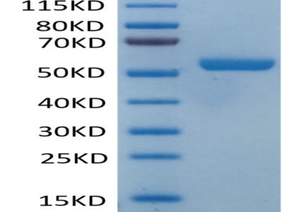 Biotinylated Human HLA-E*01