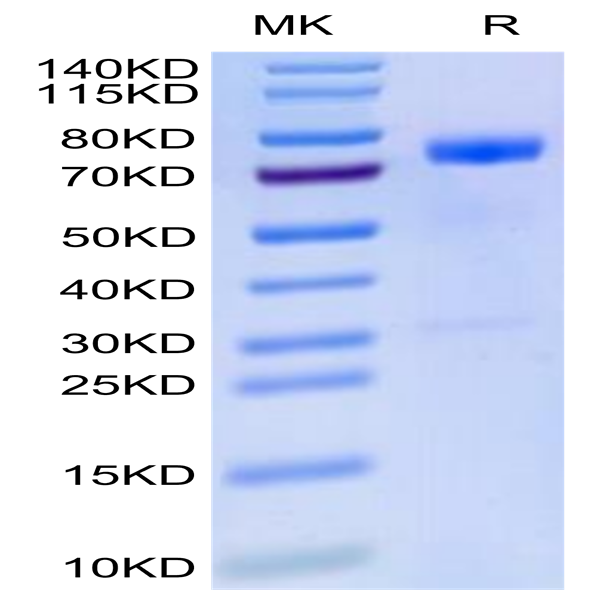 Human MICB Protein (MIC-HM20B)