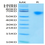 Human MICA Protein (MIC-HM40A)