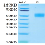 Human MICB Protein (MIC-HM40B)