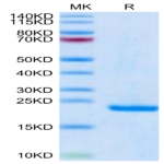 Human Midkine Protein (MID-HE401)