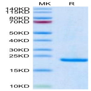 Human Midkine Protein (MID-HE401)