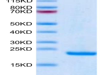 Human Midkine Protein (MID-HE401)