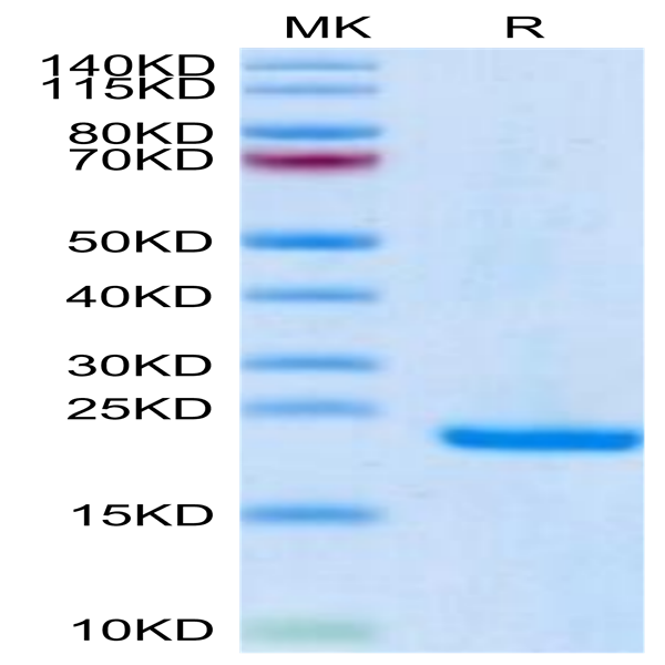 Human Midkine Protein (MID-HE401) Human Midkine Protein (MID-HE401)