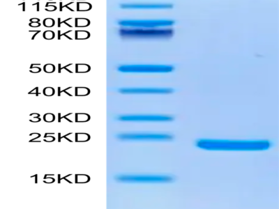 Biotinylated Human Midkine Protein (MID-HM401B)