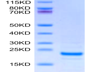 Mouse Midkine Protein (MID-ME101)