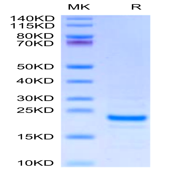Mouse Midkine Protein (MID-ME101) Mouse Midkine Protein (MID-ME101)