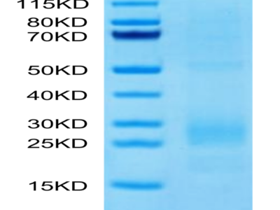 Human MIF Protein (MIF-HM101)