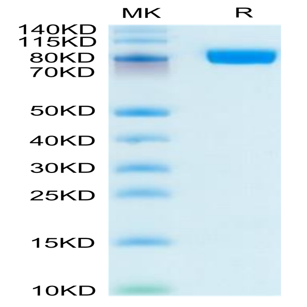 Human CD10/MME Protein (MME-HM110)