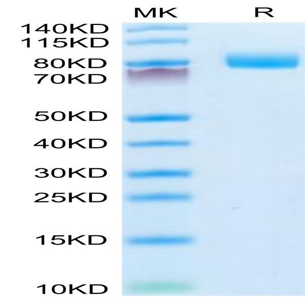 Mouse CD10/MME Protein (MME-MM110)