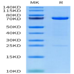 Human MMP-2 Protein (pro form) (MMP-HM102)