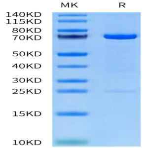 Human MMP-2 Protein (pro form) (MMP-HM102)