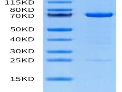 Human MMP-2 Protein (pro form) (MMP-HM102)