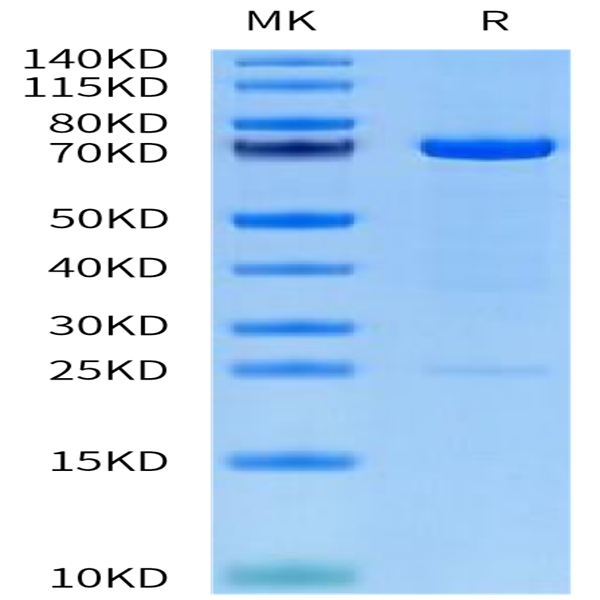Human MMP-2 Protein (pro form) (MMP-HM102) Human MMP-2 Protein (pro form) (MMP-HM102)