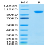 Human MMP-9 Protein (MMP-HM409)