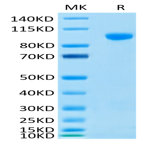 Human MMP-9 Protein (MMP-HM409)