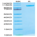 Biotinylated Human MMP-9 Protein (MMP-HM409B)