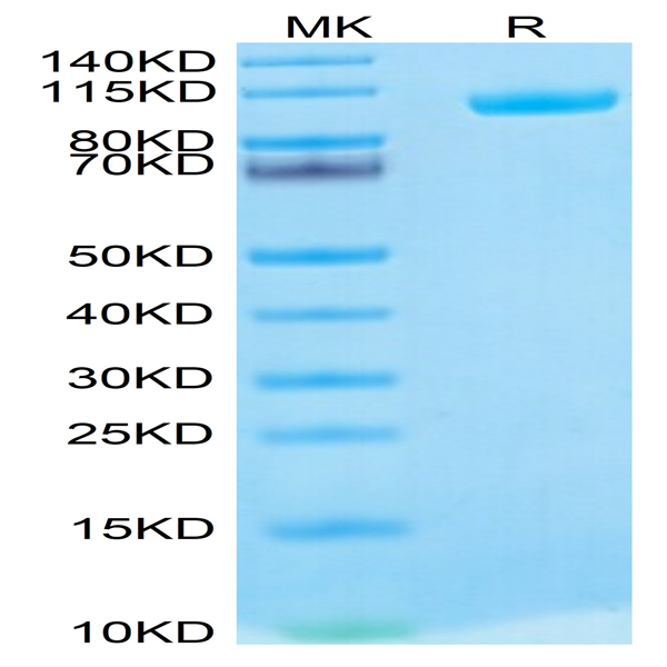 Biotinylated Human MMP-9 Protein (MMP-HM409B)