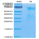 Mouse MMP-8 Protein (pro form) (MMP-MM108)