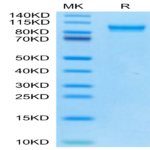 Mouse MMP-9 Protein (MMP-MM109)