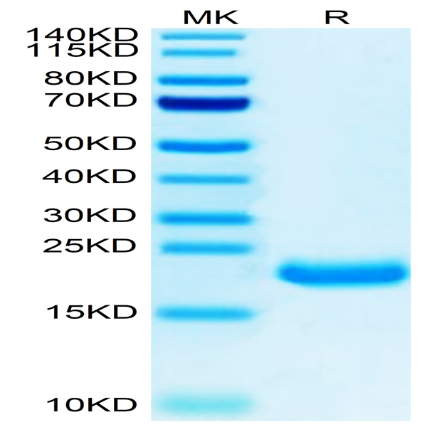 Human MOG/Myelin Oligodendrocyte Glycoprotein Protein (MOG-HM101)