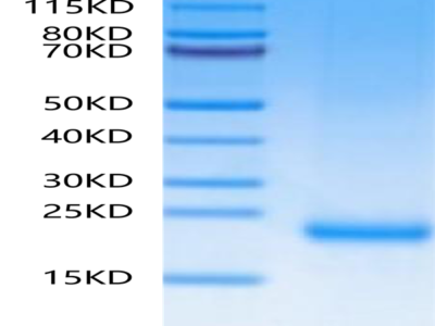 Mouse MOG/Myelin Oligodendrocyte Glycoprotein Protein (MOG-MM101)