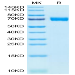 Human MRC2 Protein (MRC-HM102)