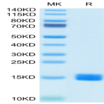 Human MARCO Protein (MRO-HM102)