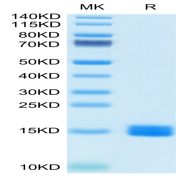 Human MARCO Protein (MRO-HM102)