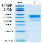 Biotinylated Cynomolgus MSLN/Mesothelin Protein (Primary Amine Labeling) (MSL-CM180B)