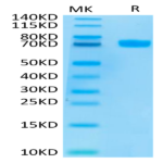 Human MSLN/Mesothelin Protein (MSL-HM280)