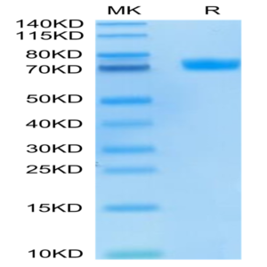 FITC-Labeled Human MSLN/Mesothelin Protein (MSL-HM280F)