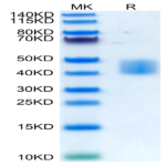 Human MSLN/Mesothelin Protein (MSL-HM480)