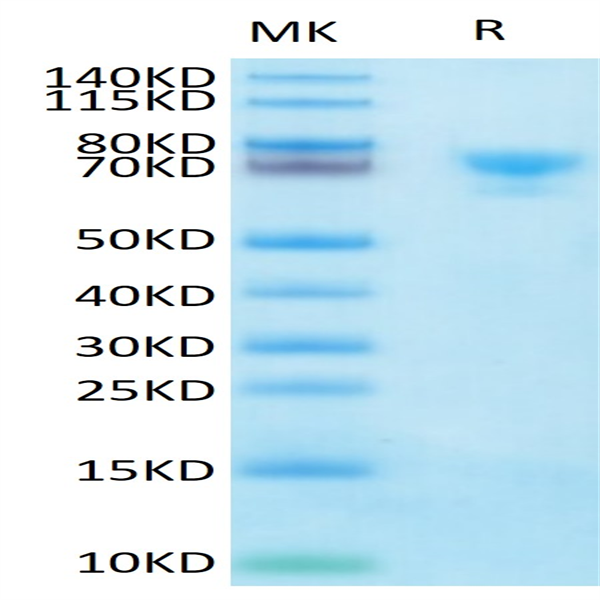 Biotinylated Human MSLN/Mesothelin Protein (MSL-HM580B)
