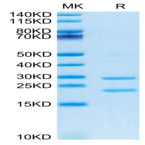 Cynomolgus MASP2 Protein (MSP-CE102)