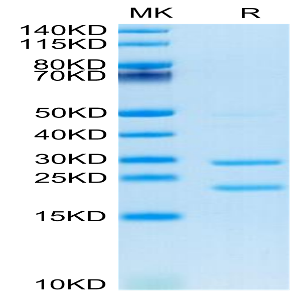 Cynomolgus MASP2 Protein (MSP-CE102)
