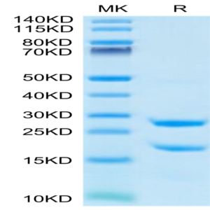 Rat MASP2 Protein (MSP-RE102)