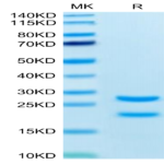 Biotinylated Rat MASP2 Protein (Primary Amine Labeling) (MSP-RE102B)