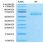 Human MUC1 Isoform Y Protein (MUC-HM2Y1)