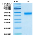 Human MXRA8 Protein (MXR-HM1A8)