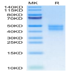 Mouse MXRA8 Protein (MXR-MM1A8)