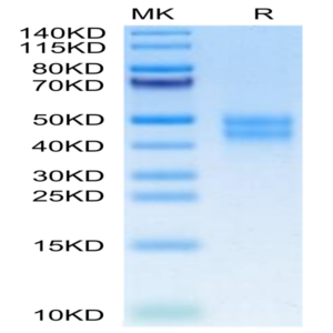 Mouse MXRA8 Protein (MXR-MM1A8)