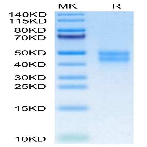 Mouse MXRA8 Protein (MXR-MM1A8)