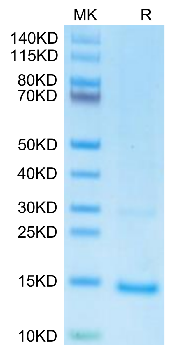 Monkeypox virus A29 Protein, A29-VE129 Monkeypox virus A29 Protein, A29-VE129 Ushelf